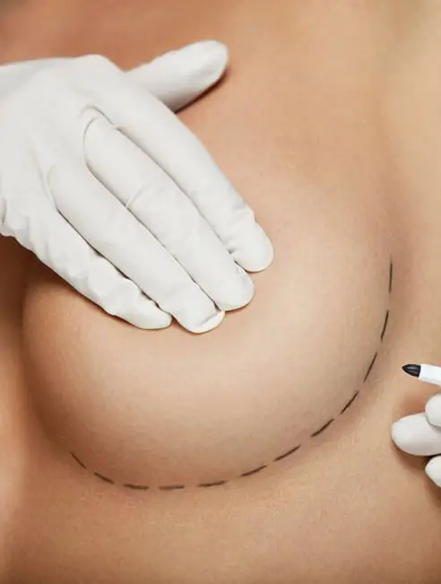 Chirurgia Sanilor - Doctor Natalia Dumitrescu