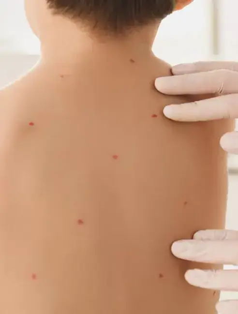 Dermatologie Pediatrica - doctor Natalia Dumitrescu