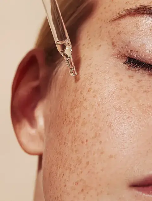 Estetica​ - Acid Hialuronic - Doctor Natalia Dumitrescu