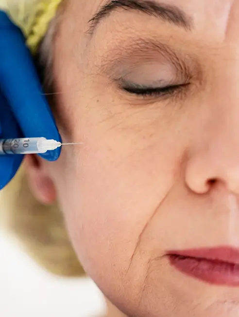 Estetica​ - Toxina Botulinica - Doctor Natalia Dumitrescu