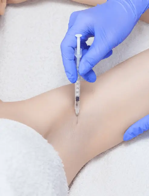 Estetica​ - Tratament Hiperhidroza - Doctor Natalia Dumitrescu
